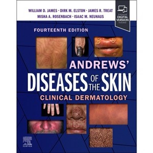 Andrews' Diseases of the Skin - 14th Edition by  William D James & Dirk M Elston & James R Treat & Misha Rosenbach (Hardcover) - 1 of 1
