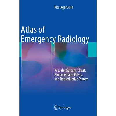 Atlas of Emergency Radiology - by  Rita Agarwala (Hardcover)