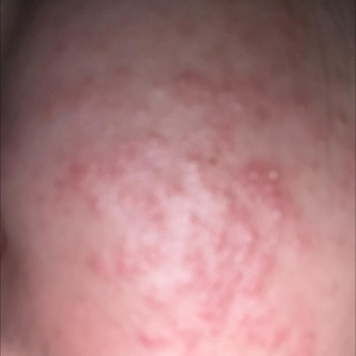 Guest review image 1 of 1, zoom in