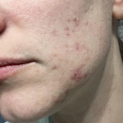 Guest review image 1 of 2, zoom in