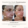 Project E Beauty LightAura LED Mask | 7 Colors Led Face Mask Light Therapy | Red Light Therapy for Face | Anti-aging Anti-Acne |Facial |Skincare - 4 of 4
