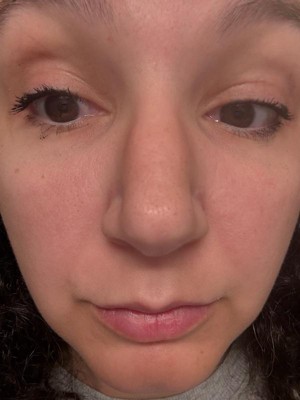 Guest review image 1 of 2, zoom in