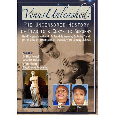 Venus Unleashed: Uncensored History of Plastic Surgery (DVD)(2014)