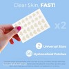 MEDca Hydrocolloid Acne Patches for Face – 56-Count Pimple Spot Bandages in Hearts & Stars for Acne, Zits & Blackheads - 2 of 4