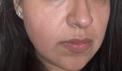 Guest review image 1 of 4, zoom in