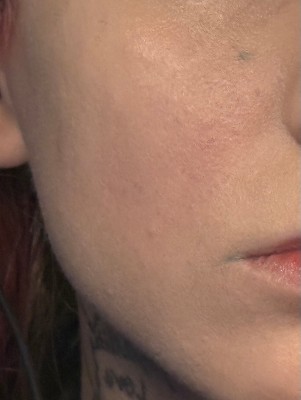 Guest review image 2 of 3, zoom in