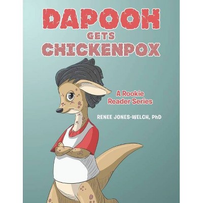 Dapooh Gets Chickenpox - by  Renee Jones-Welch (Paperback)