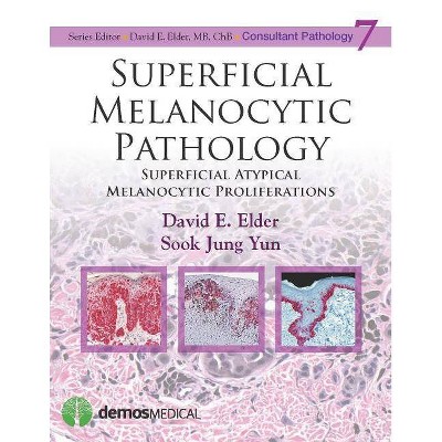 Superficial Melanocytic Pathology - (Consultant Pathology) by  David Elder & Sook Jung Yun (Hardcover)