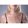 AminoGenesis Photolagen-AGF Intensive Treatment  | Skin Protection | Dull skin tones | Tiny Spider Veins - (2 oz) - 3 of 3