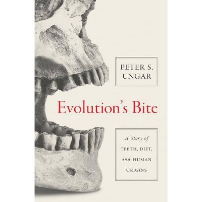 Evolution's Bite - by  Peter Ungar (Hardcover)