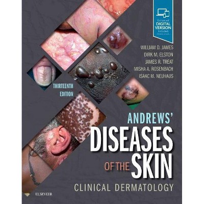 Andrews' Diseases of the Skin - 13th Edition by  William D James & Dirk MD Elston & James R Treat & Misha A Rosenbach & Robert G Micheletti