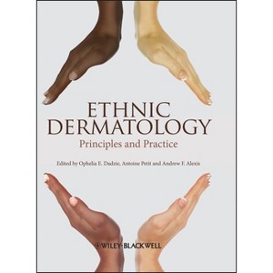 Ethnic Dermatology - by  Ophelia E Dadzie & Antoine Petit & Andrew F Alexis (Hardcover) - 1 of 1