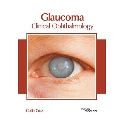 Glaucoma: Clinical Ophthalmology - by  Collin Cruz (Hardcover)