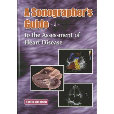 Sonographer's Guide to the Assessment of Heart Disease - by  Bonita Anderson (Hardcover)