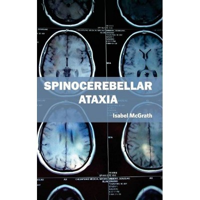 Spinocerebellar Ataxia - by  Isabel McGrath (Hardcover)