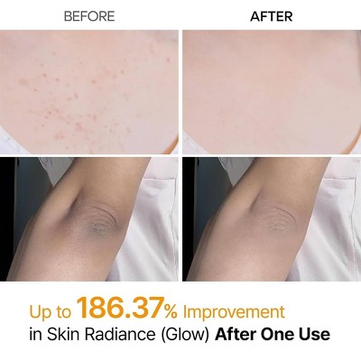 Dr.Melaxin Turmeric Facial Exfoliant Spray - 6.76 fl oz - Beauty Studio