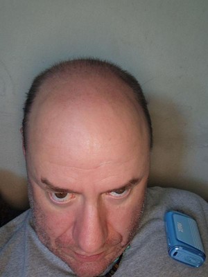 Guest review image 2 of 2, zoom in