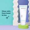 Proactiv Acne Body Wash - 9 fl oz - 3 of 4