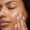 No7 Derm Solutions Daily Detox Gel Facial Cleanser - Oily and Blemish Prone Skin - 8 fl oz - 3 of 4