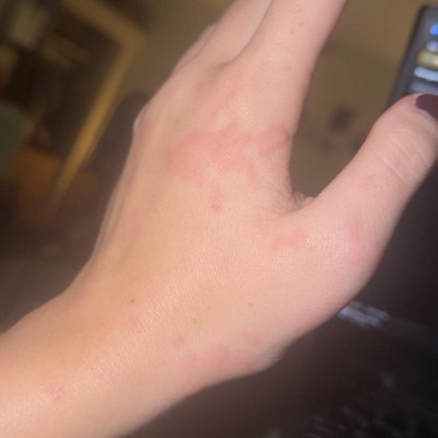 Guest review image 2 of 2, zoom in