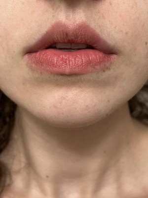 Guest review image 2 of 6, zoom in