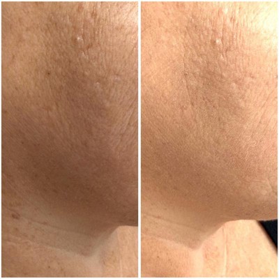 Guest review image 2 of 3, zoom in