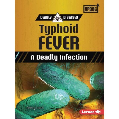 Typhoid Fever - (Deadly Diseases (Updog Books (Tm))) by  Percy Leed (Paperback)