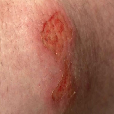 Guest review image 1 of 1, zoom in