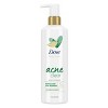 Dove Beauty Body Love Salicyclic Acid + Bamboo Extract Acne Clear Body Cleanser - 17.5 fl oz - image 2 of 4