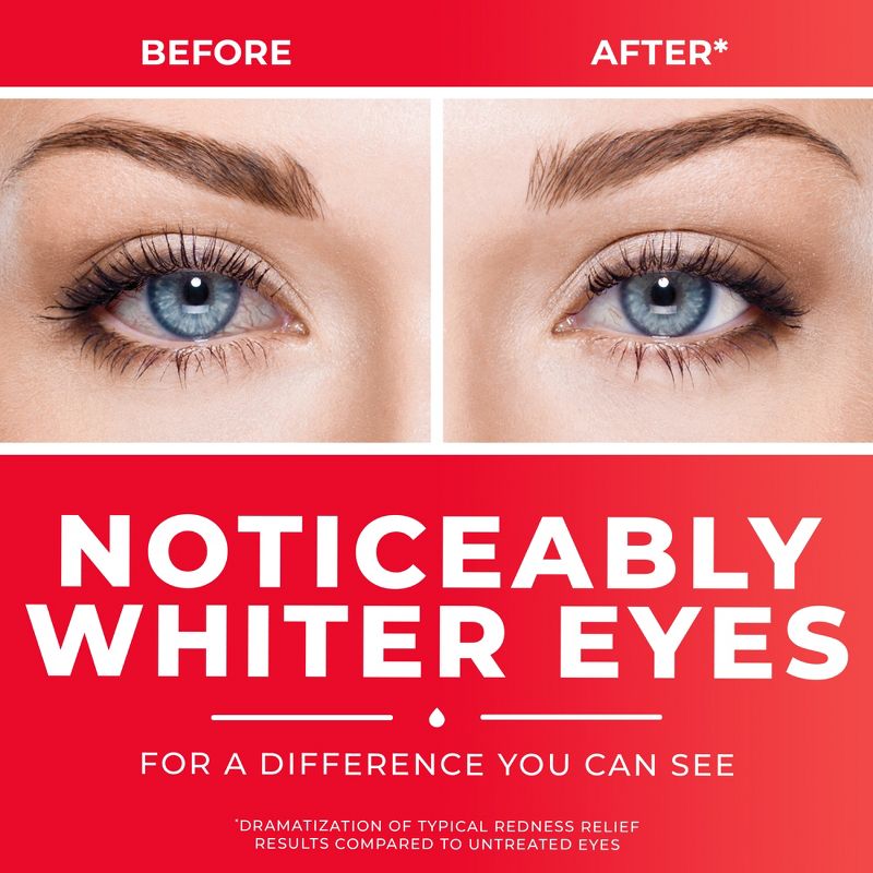Clear Eyes Redness Relief Eye Drops for Redness, Dryness, Burning, &#38; Irritation - 0.5 fl oz, 5 of 7