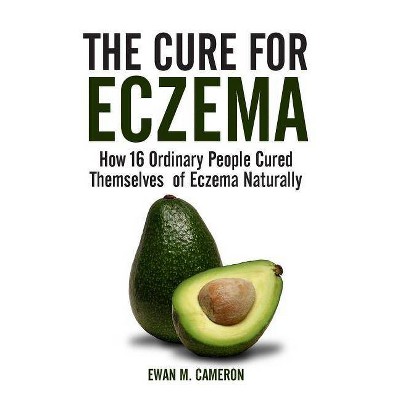 The Cure for Eczema - by  Ewan M Cameron (Hardcover)