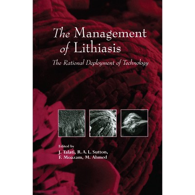 The Management of Lithiasis - (Mathematics and Its Applications) by  J Talati & Jamsheer Talati (Hardcover)