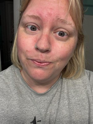 Guest review image 1 of 2, zoom in