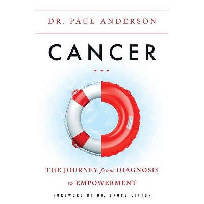 Cancer - by  Paul Anderson (Paperback)