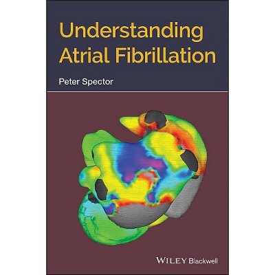 Understanding Atrial Fibrillation - by  Peter Spector (Paperback)