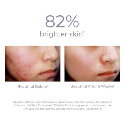 Vitamin C 10% Multi-Acid Radiance Liquid Peel for Dry Skin