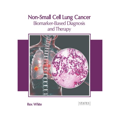 Non-Small Cell Lung Cancer: Biomarker-Based Diagnosis and Therapy - by  Rex White (Hardcover)