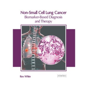 Non-Small Cell Lung Cancer: Biomarker-Based Diagnosis and Therapy - by  Rex White (Hardcover) - 1 of 1