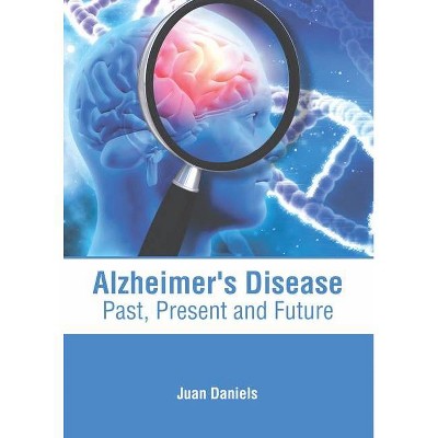 Alzheimer's Disease: Past, Present and Future - by  Juan Daniels (Hardcover)