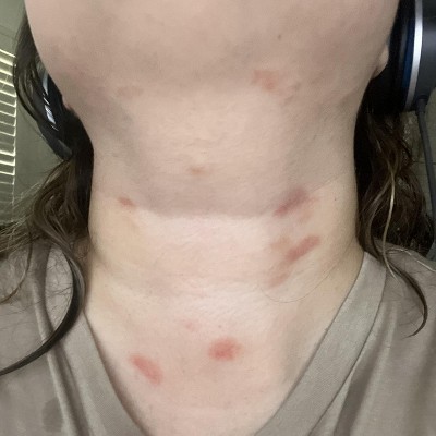 Guest review image 1 of 1, zoom in