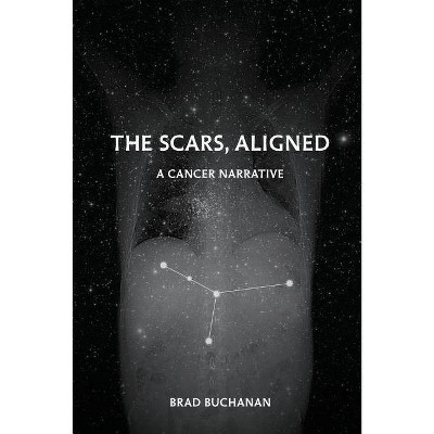 The Scars, Aligned - by  Brad Buchanan (Paperback)