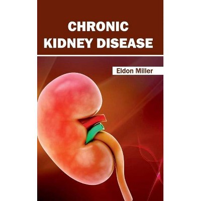 Chronic Kidney Disease - by  Eldon Miller (Hardcover)