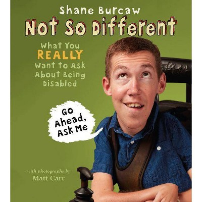 Not So Different - by  Shane Burcaw (Hardcover)