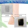 5 Star Super Deals Japanese Deluxe Foot Pads – Natural Bamboo Vinegar & Charcoal for Overnight Wellness, 28 Pads + Adhesives - 3 of 4
