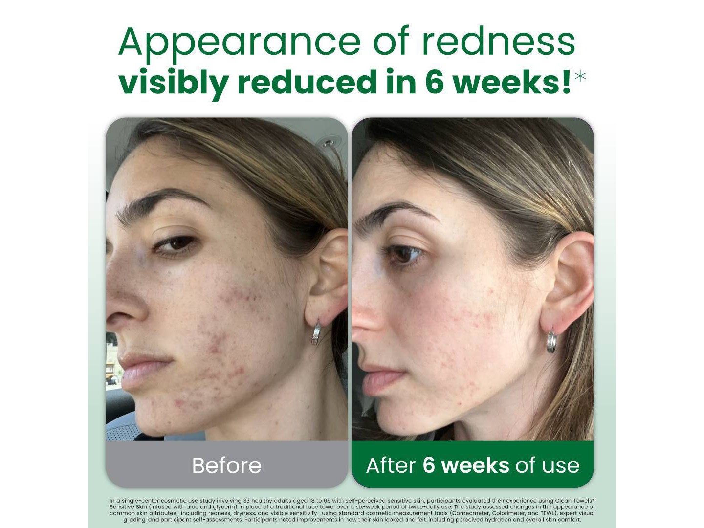 Полотенца Clean Skin Club for Sensitive Skin - XL - 50ct — фото 3