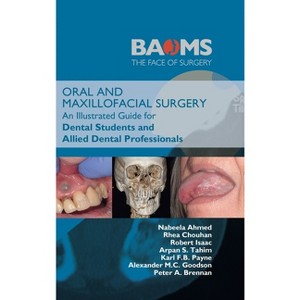 Oral and Maxillofacial Surgery - by  Nabeela Ahmed & Rhea Chouhan & Robert Isaac (Hardcover) - 1 of 1