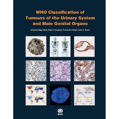 WHO Classification of Tumours of the Urinary System and Male Genital Organs - 4th Edition by  Who Classification of Tumours Editorial Board