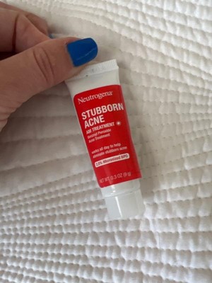 Neutrogena Stubborn Acne Morning Face Treatment With Benzoyl Peroxide ...