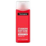Neutrogena Stubborn Body Acne Cleanser - 8.5 fl oz