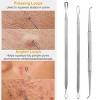 7 Pcs Blackhead Remover Kit Stainless Steel Pimple Comedone Acne Extractor Needle Tools - 4 of 4
